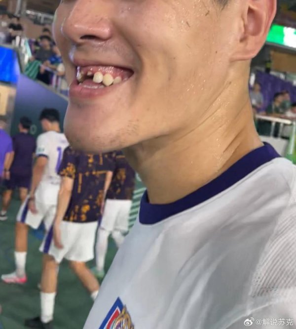 009配资 记者：王献均门牙留在了黄龙体育中心，很多人一起找都没找到